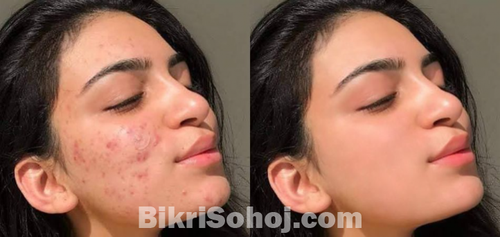 Photo retouching service